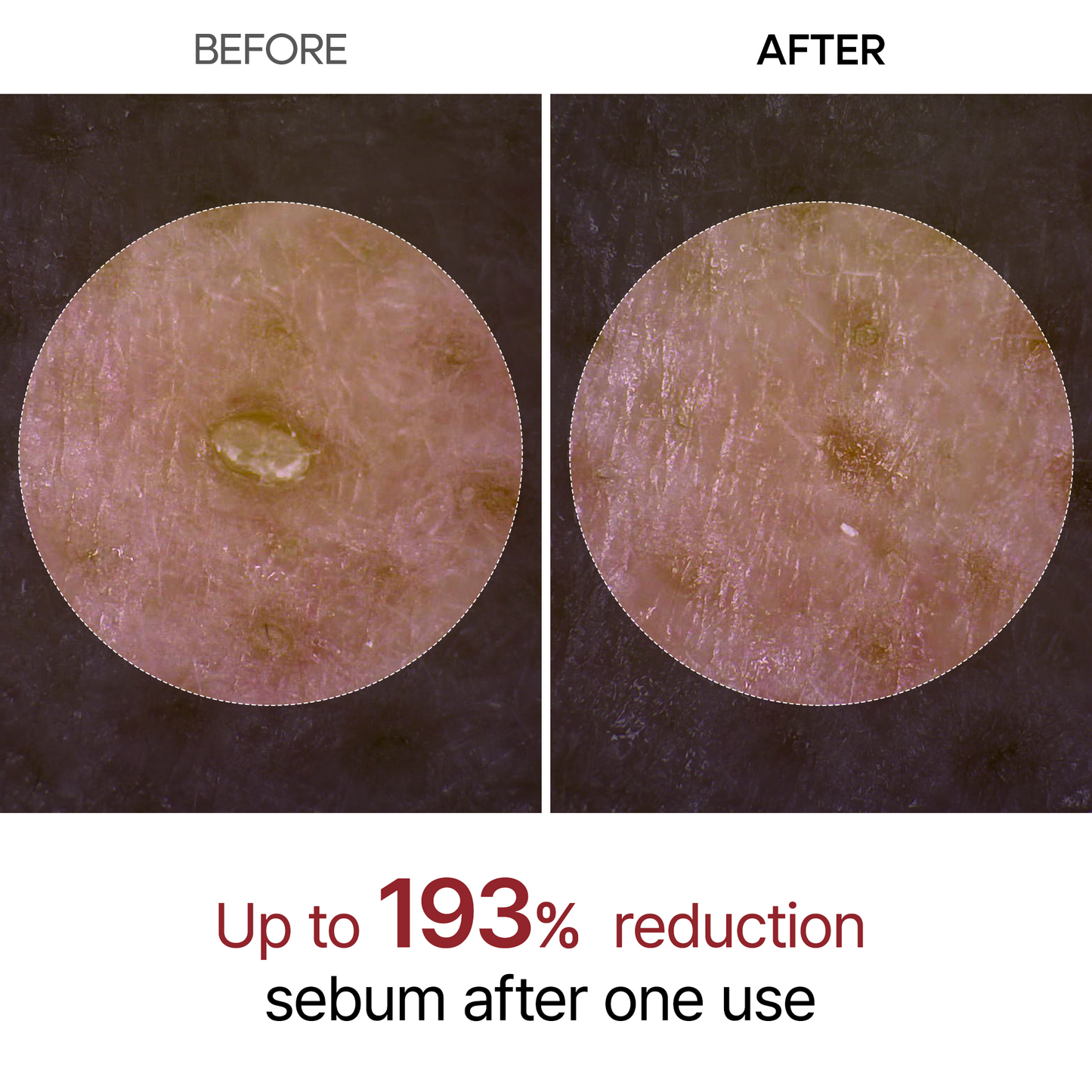 Peel Shot Glow Rice Line dead skin and pigmentation remover