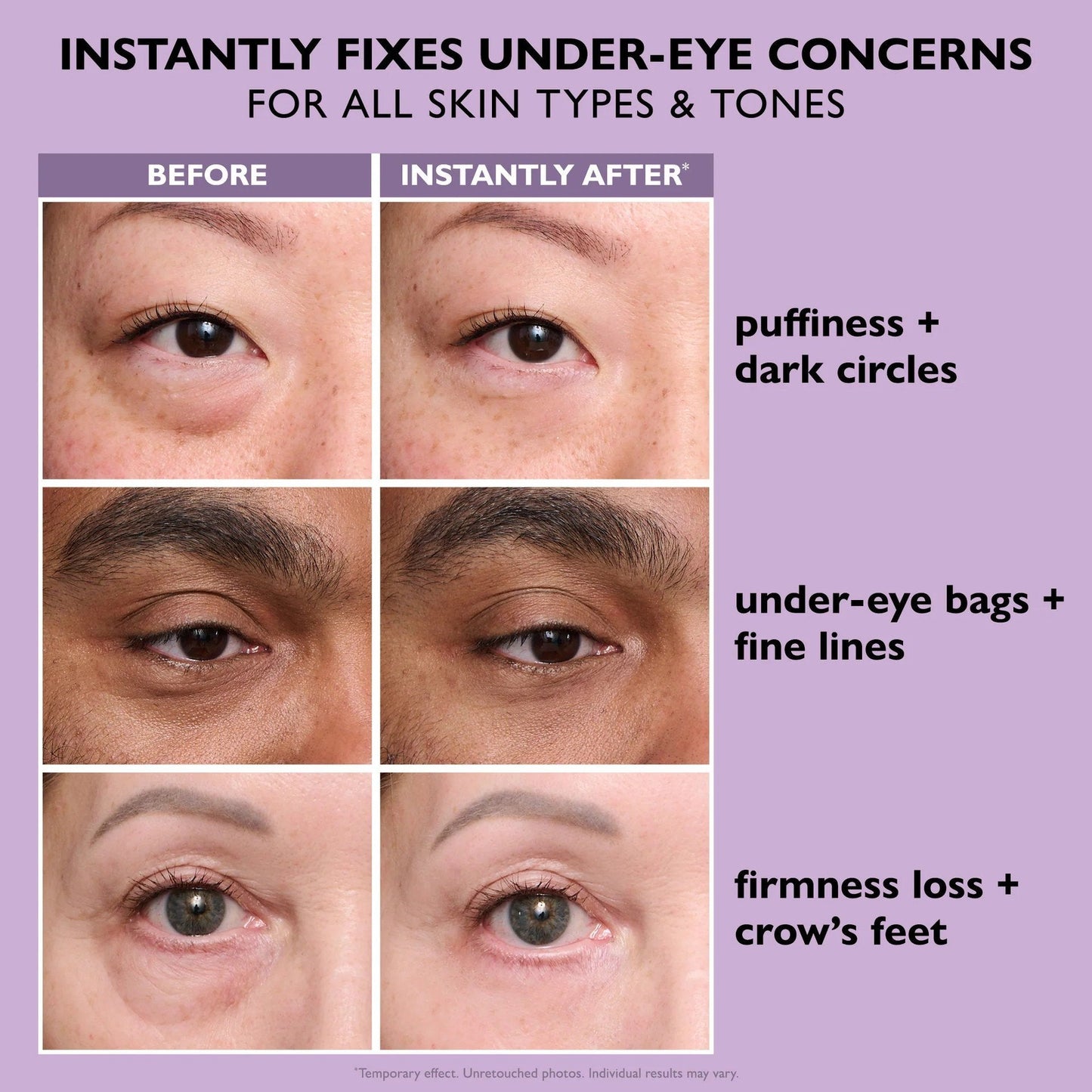 Peter & Thomas Roth Firming eye cream