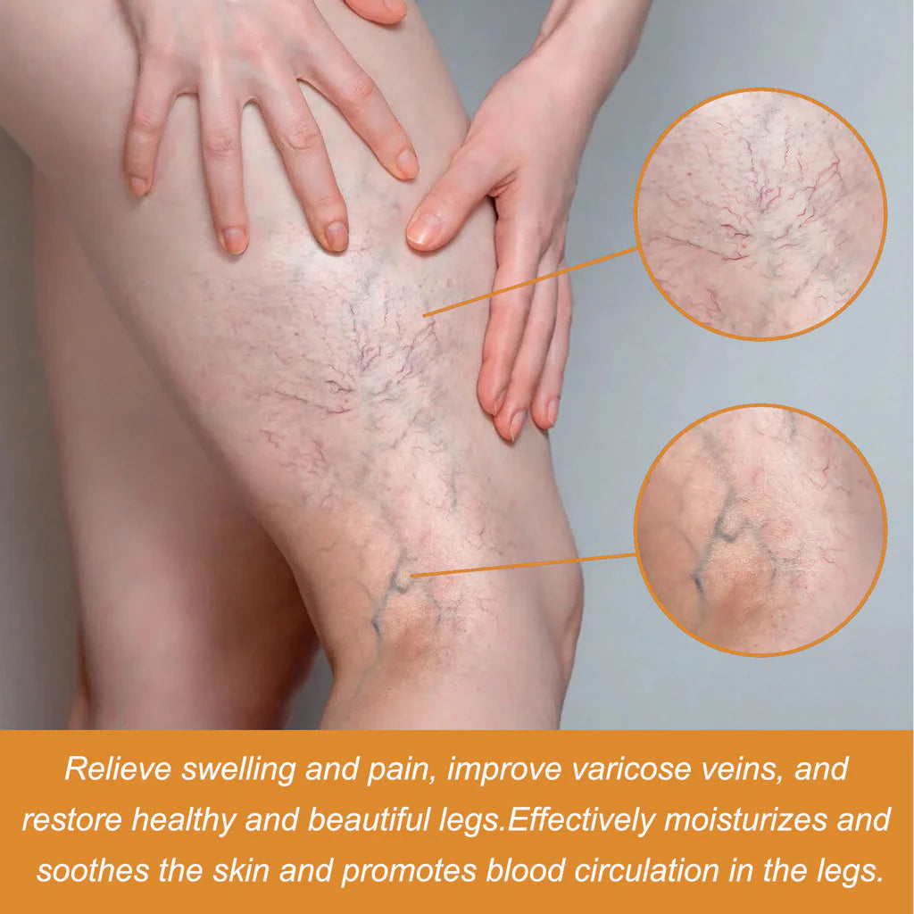 Turmeric Varicose Vein Relief (pack of 3)