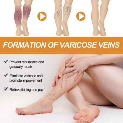 Turmeric Varicose Vein Relief (pack of 3)