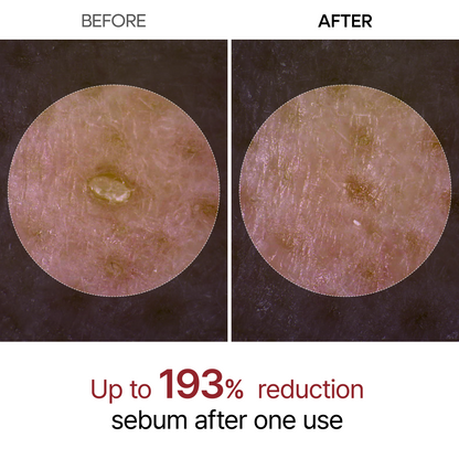 Peel Shot Glow Rice Line dead skin and pigmentation remover