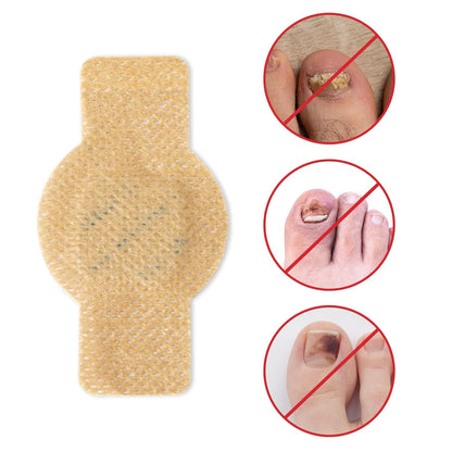Elaimei™ - Fungal Nail Patches ( Buy 1 Get 1 Free)